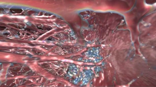 Le Covid-19 filmé pour la première fois : ces images exclusives pour comprendre son effet sur les poumons